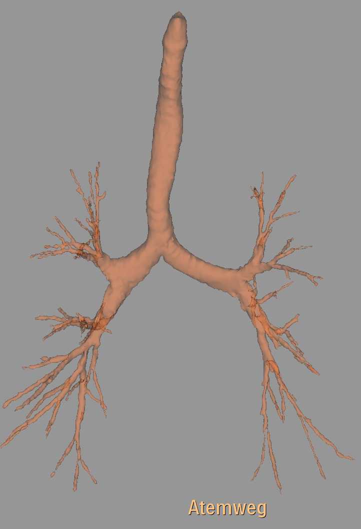 Atemwege segmentiert in 3D